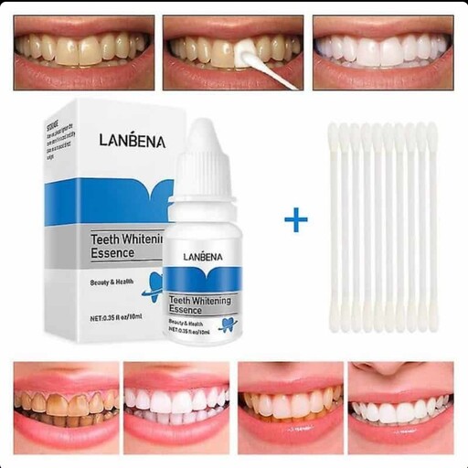 قطره سفید کننده دندان مدل LANBENA